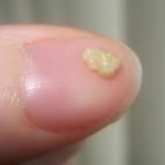 臭い玉の写真です。